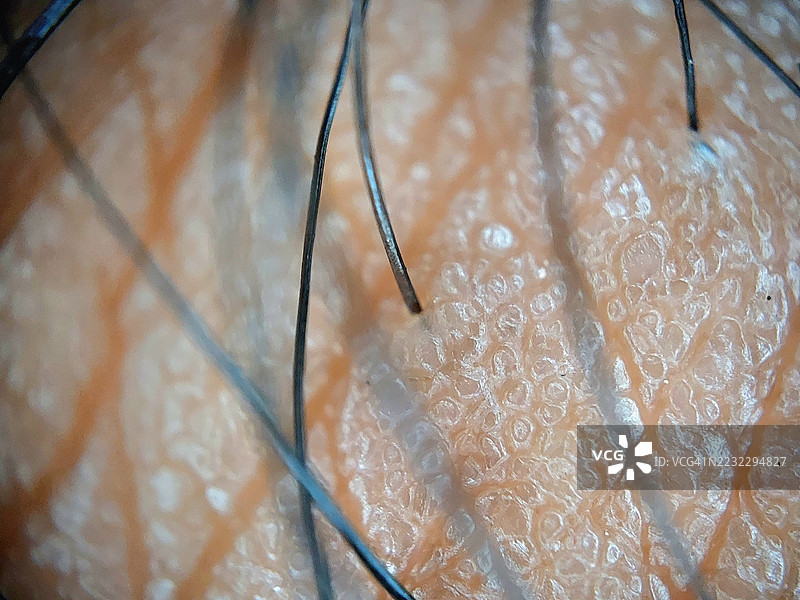 人类皮肤表面的极端微距特写，清晰可见的毛囊和表皮纹理细节图片素材