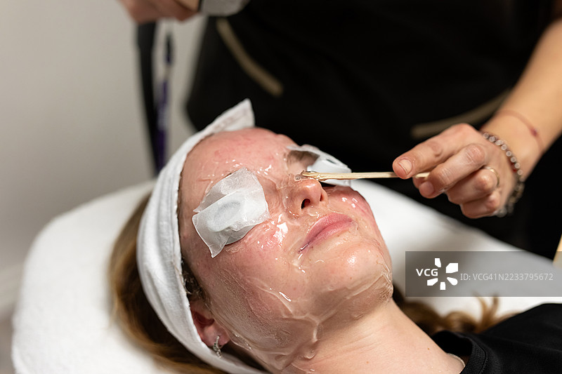 青少年女孩接受抗痘激光治疗的应用图片素材