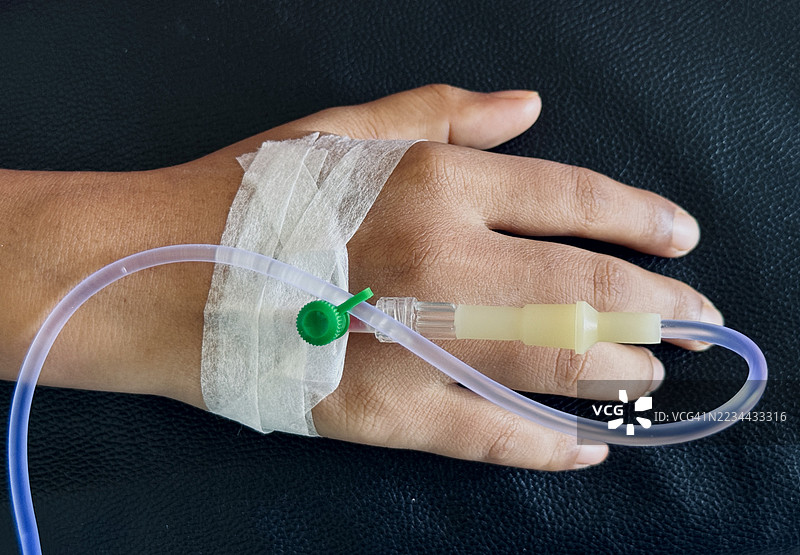 患者手部特写，插有静脉输液针。图片素材