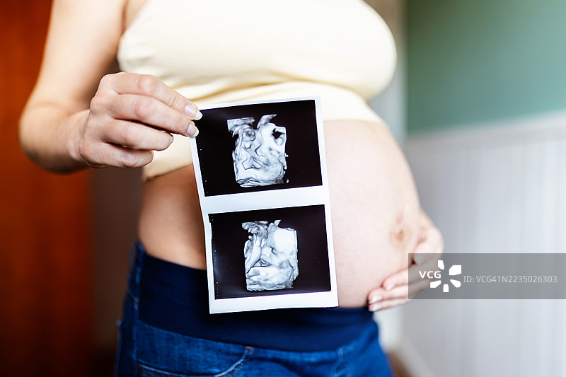 孕妇手持宝宝的超声波扫描照片图片素材