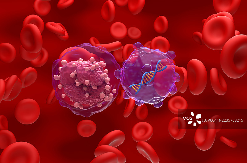急性淋巴细胞白血病的基因治疗概念插图图片素材
