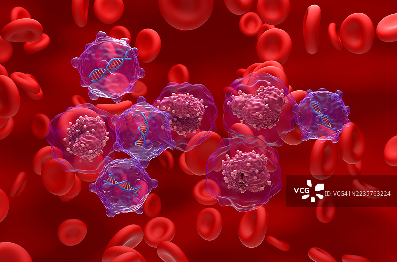 急性淋巴细胞白血病的基因治疗概念插图图片素材