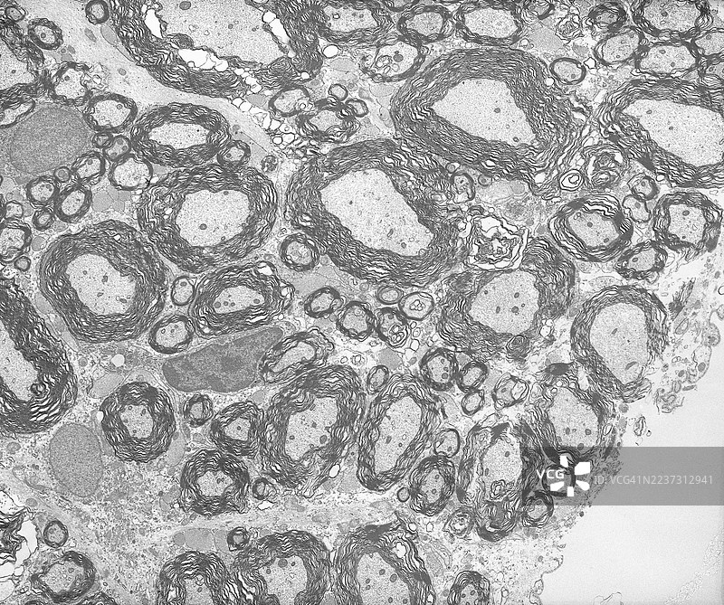脊髓神经脱髓鞘的电子显微镜图像，放大2000倍图片素材