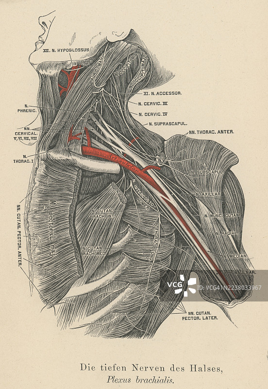古老解剖学蚀刻插图 - 臂丛神经，由下位四条颈神经和第一胸神经的前支形成的神经丛（神经丛）。图片素材