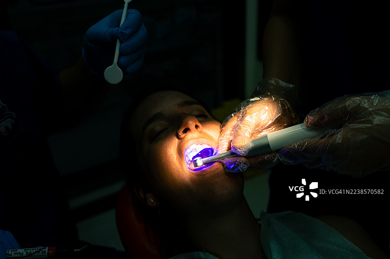 患者正在接受牙科治疗，牙医在她张开的嘴上使用蓝色紫外线固化灯，突显了先进的口腔卫生和现代牙科护理图片素材