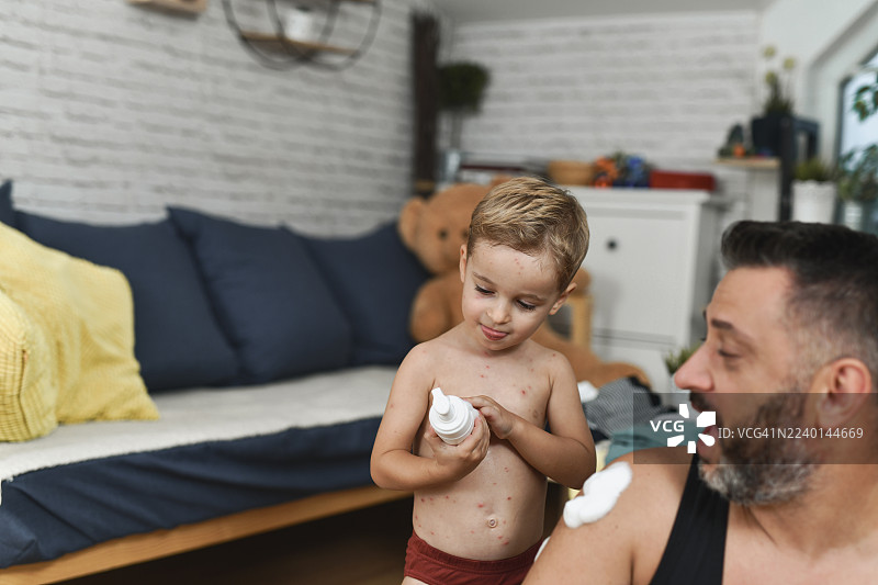 父亲在家照顾患有水痘症状的儿子，并分享欢乐时光图片素材