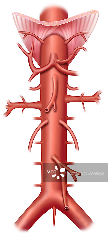 腹主动脉解剖图，插画图片素材