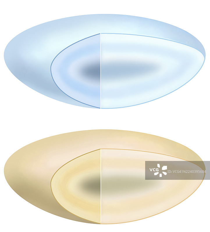健康和白内障晶状体，插画图片素材
