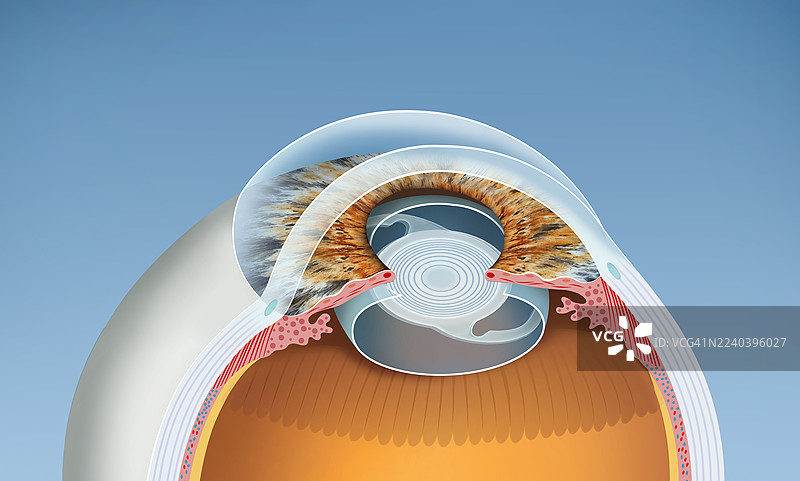 眼内镜植入，插画图片素材
