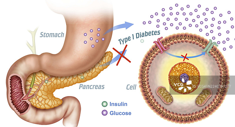 胰岛素与血糖控制，插画图片素材