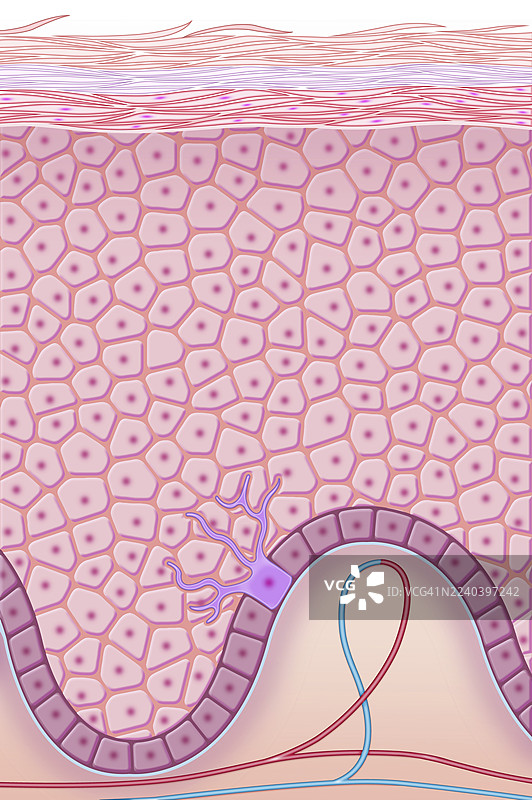 表皮角质化，插画图片素材