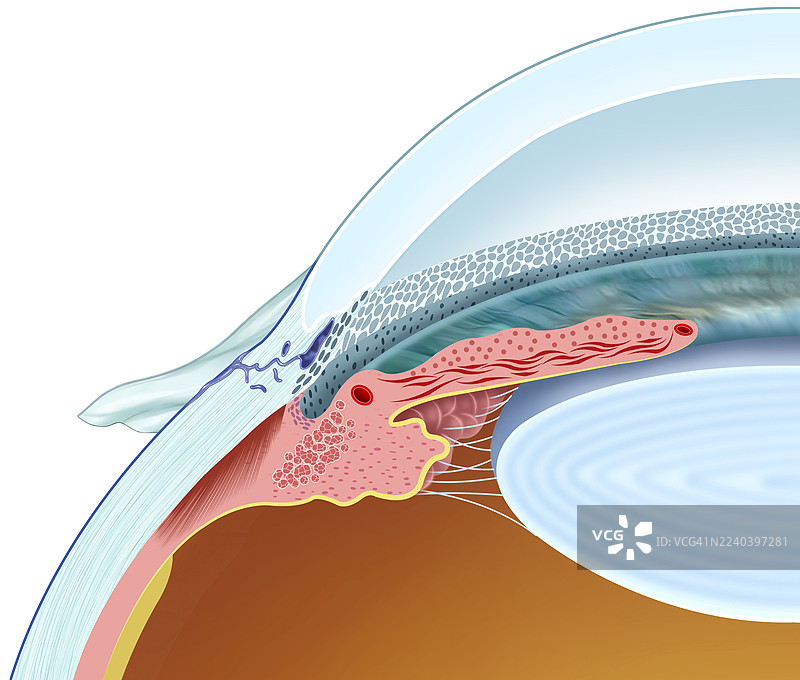 施莱姆管示意图图片素材