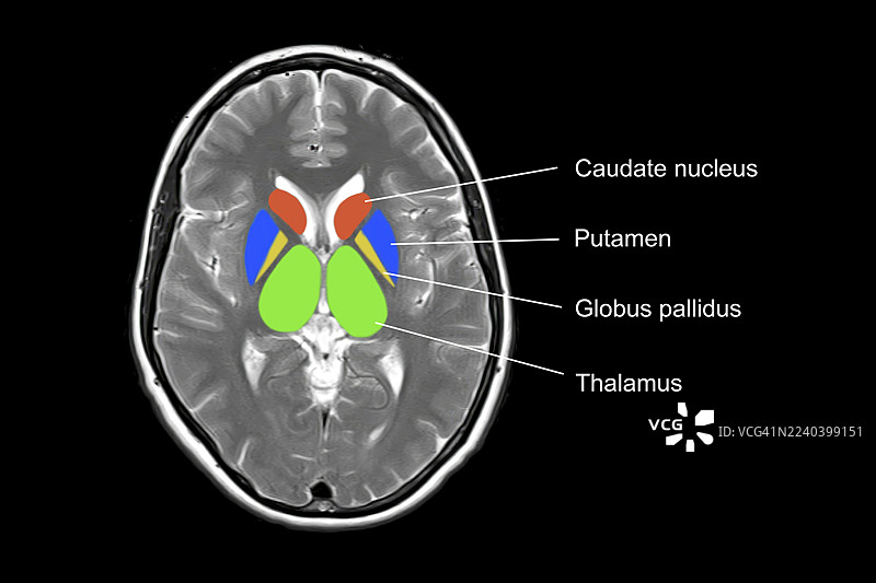 正常大脑解剖结构，MRI扫描图片素材