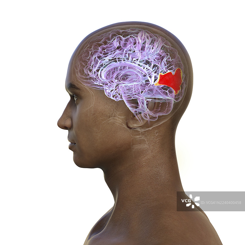 插画：大脑中被高亮的楔叶回图片素材
