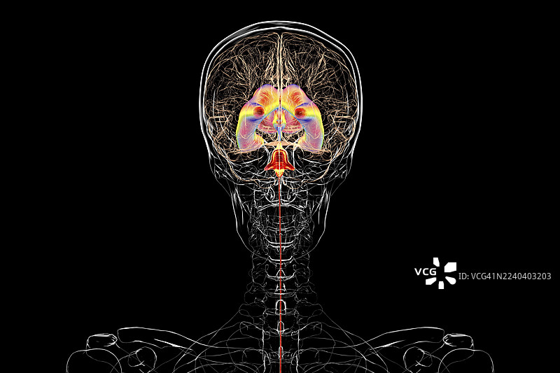正常压力脑积水，插画图片素材
