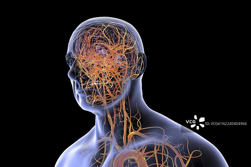 大脑动脉，插画图片素材