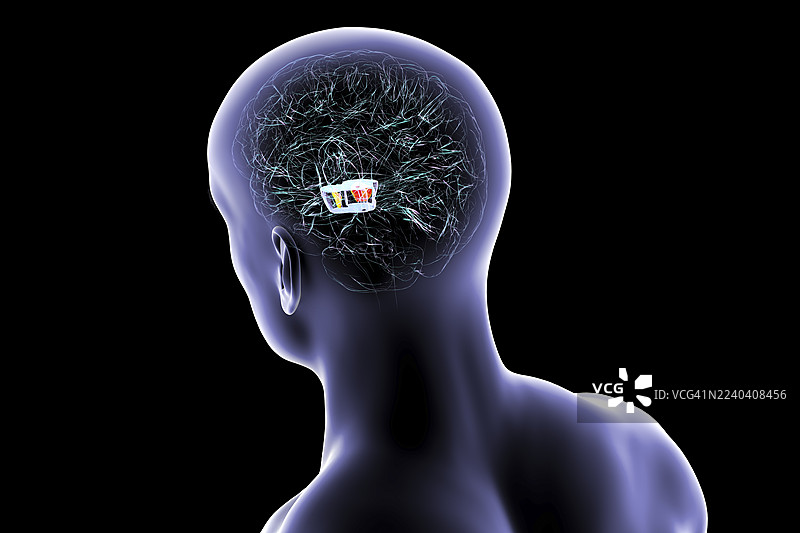 高亮显示了黑质的人脑插画图片素材