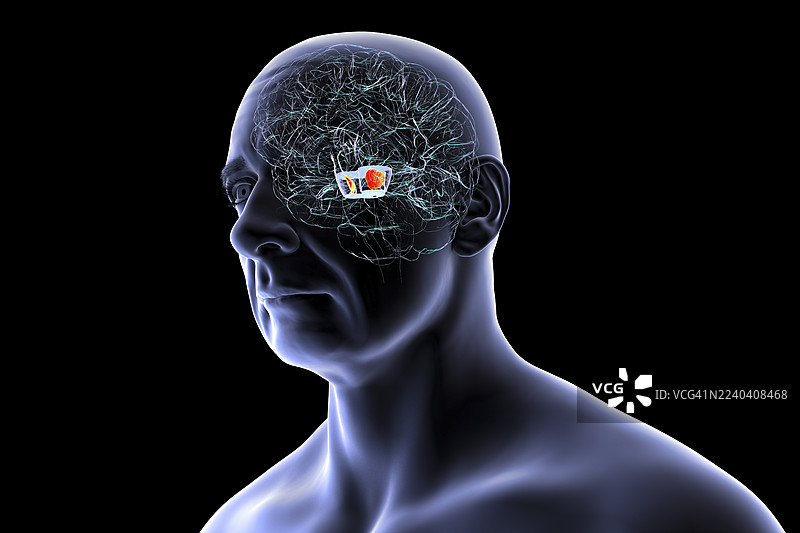 高亮显示黑质的人脑插画图片素材