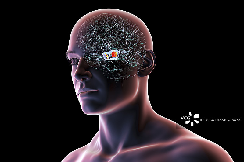 大脑显现出黑质区域，插画图片素材