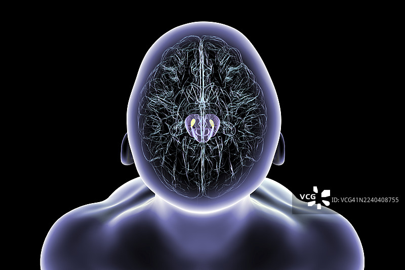 帕金森氏症退化的黑质，插画图片素材