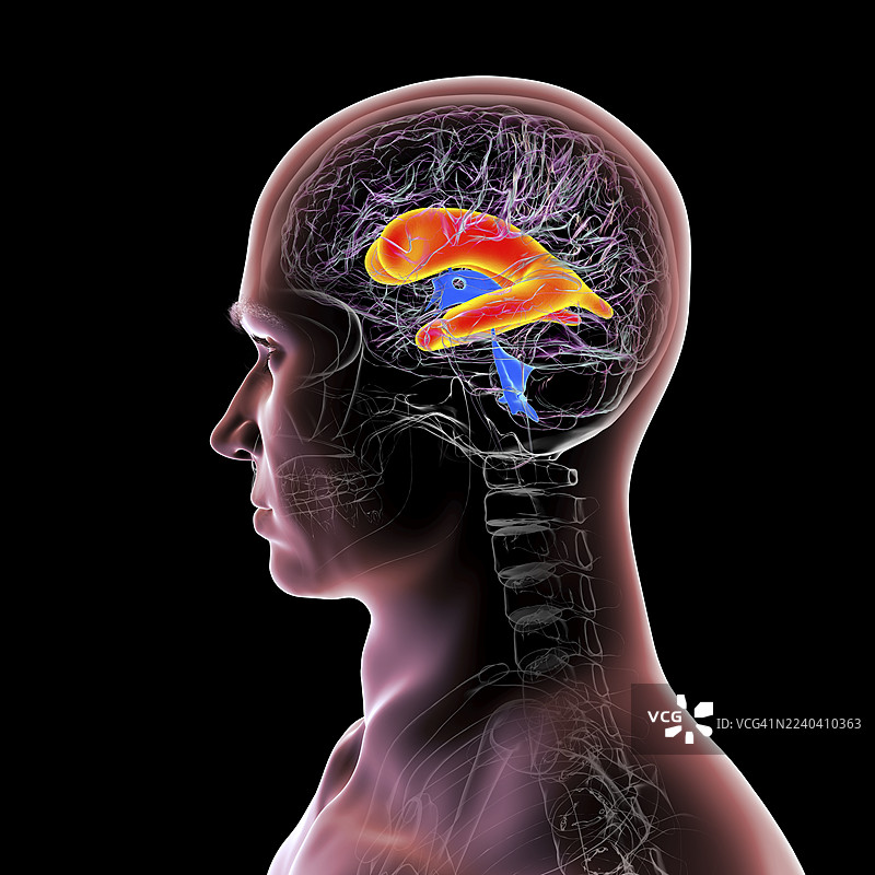 脑室增大的大脑，插画图片素材