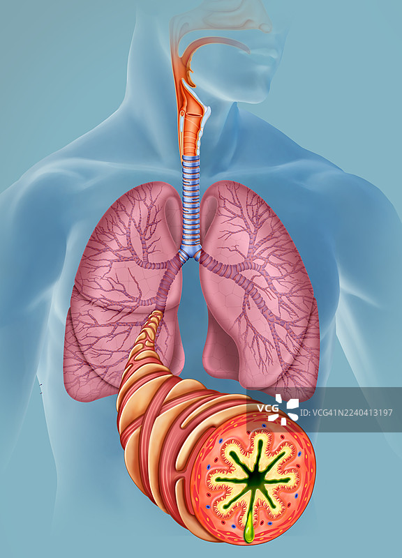 哮喘影响的支气管，插画图片素材