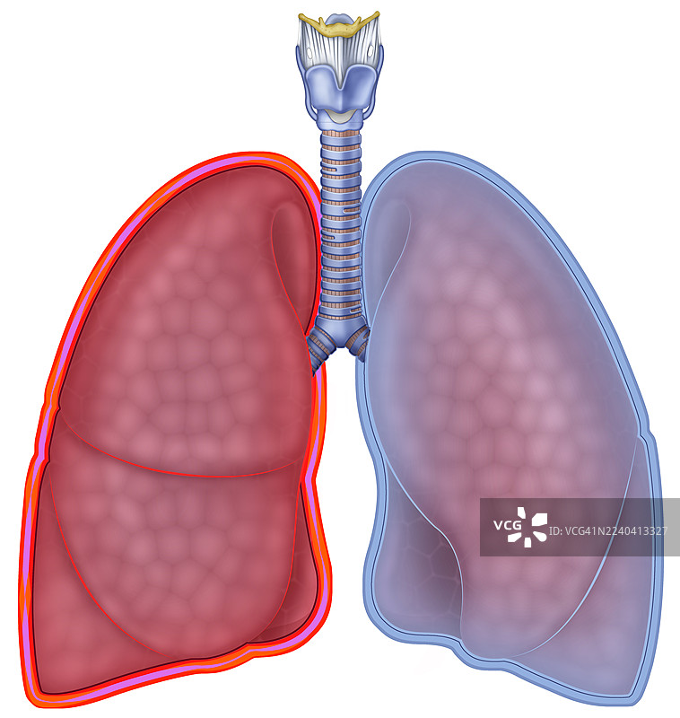肺胸膜炎，插画图片素材