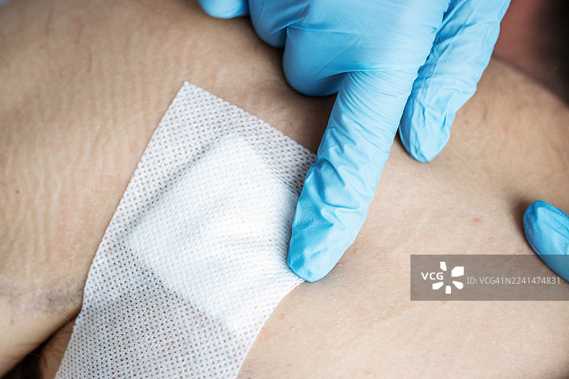 医务人员在患者皮肤上固定胶布。临床环境下的伤口护理程序。图片素材