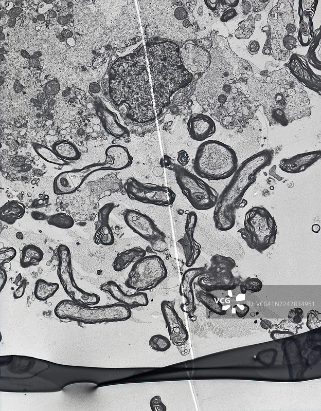 电子显微镜图像，显示钻石刀在超薄切片过程中的单个划痕和折叠部分，放大4000倍图片素材