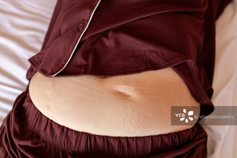 截取的女性腹部带疤痕的镜头图片素材