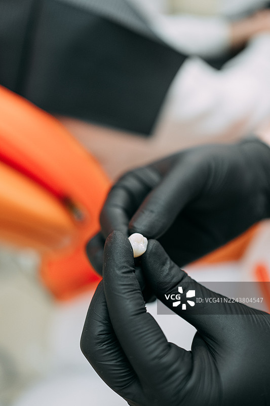 牙医双手持用于种植准备的牙冠图片素材