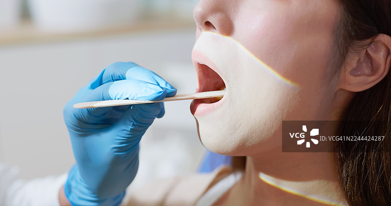 耳鼻喉科医生使用压舌板检查患者喉咙图片素材
