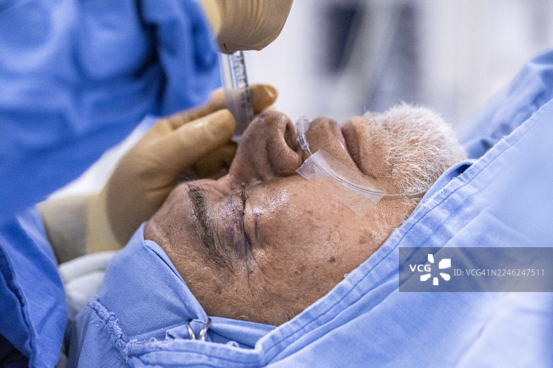 上睑成形术 面部年轻化的眼睑美容手术 这种手术用于矫正眼睑下垂、去除多余皮肤（皮肤松弛）和眼袋，以达到面部年轻化的效果。图片素材