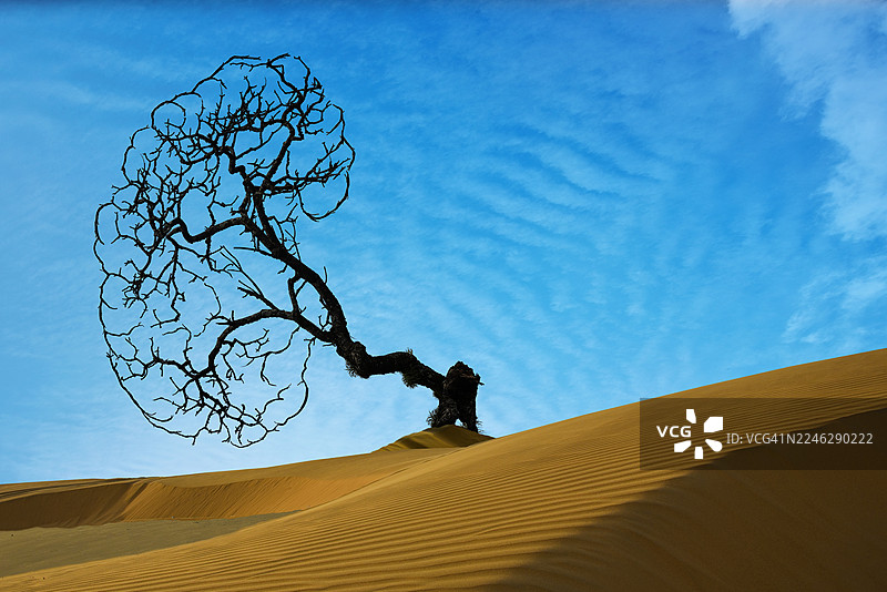 慢性肾脏病 (CKD)图片素材