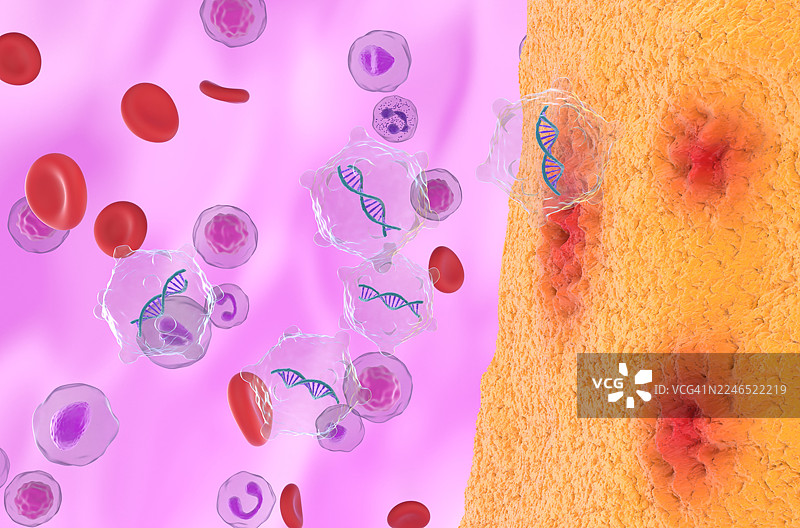 类风湿关节炎基因疗法，概念插画图片素材