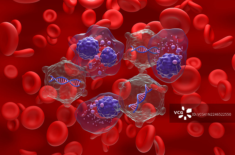 多发性骨髓瘤的基因疗法，概念插画图片素材