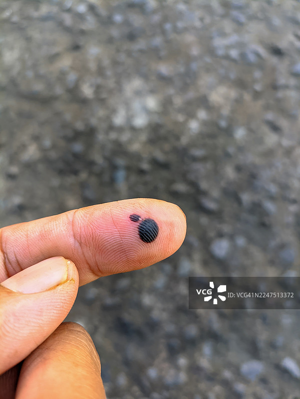 特写镜头，一只人类手指上有一个黑点，可能是墨迹或小虫子，背景模糊图片素材