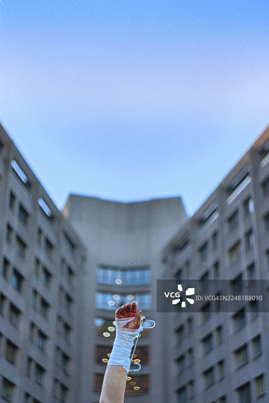 在柏林克罗伊茨贝格的综合医院前，展示着打着石膏的骨折前臂，可见用于临时治疗的、跨越关节的外部固定器。图片素材