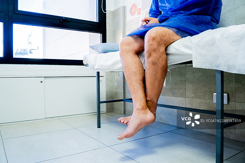 医院担架上病人的下半身特写图片素材