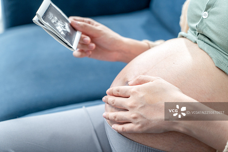 怀孕的女人拿着超声波图像。怀孕、医疗保健、妇科、医学的概念。年轻的母亲等待着宝宝的降生。图片素材