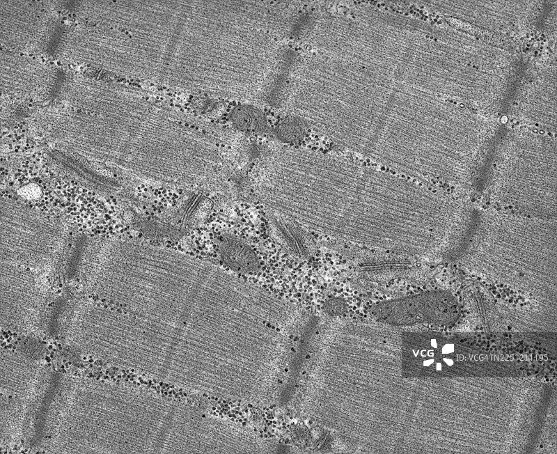 骨骼肌透射电子显微镜图片素材