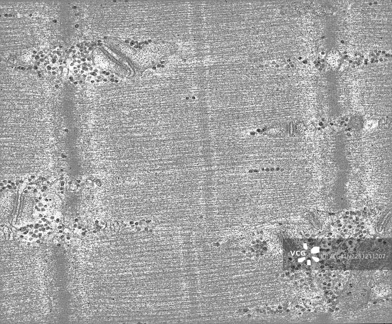 骨骼肌透射电子显微镜图片素材