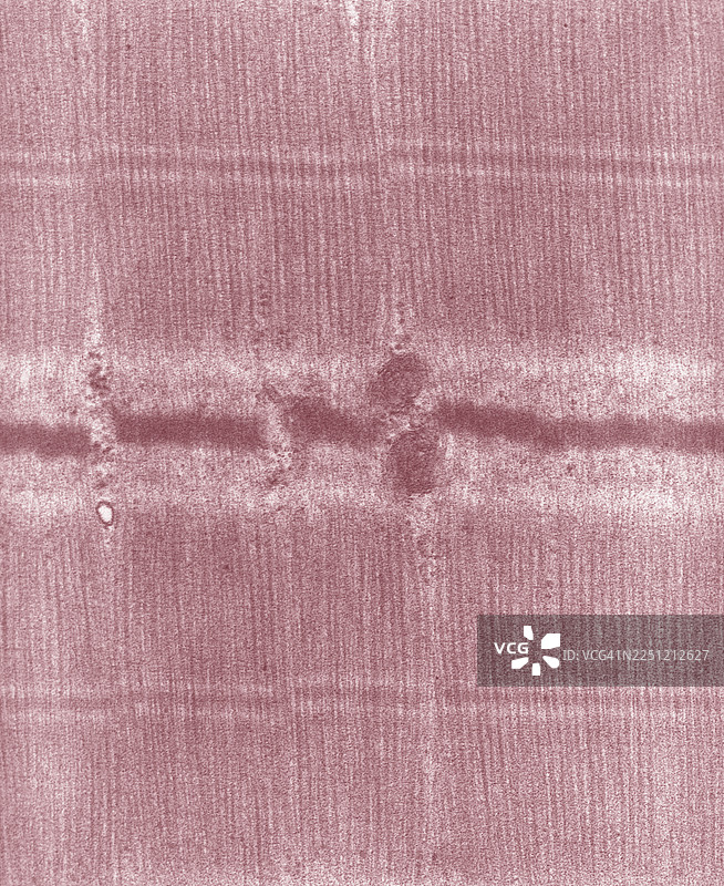 骨骼肌，明带，暗带，透射电子显微镜，肌纤维图片素材