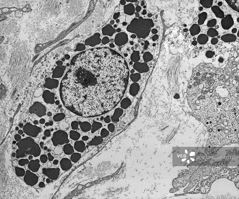 肥大细胞、组胺、电子显微镜、炎症、白细胞图片素材
