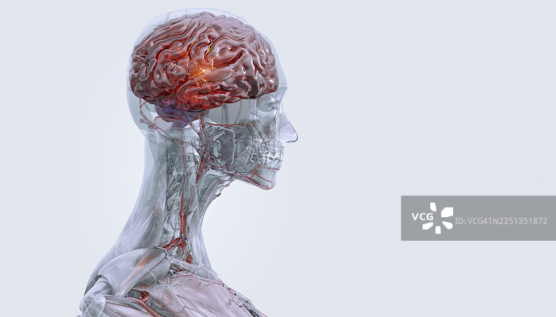 大脑疾病，概念插画图片素材