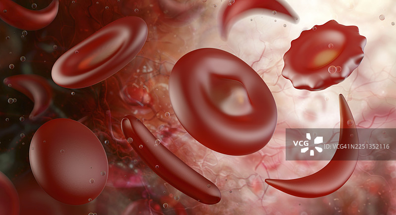 红细胞异常，插画图片素材