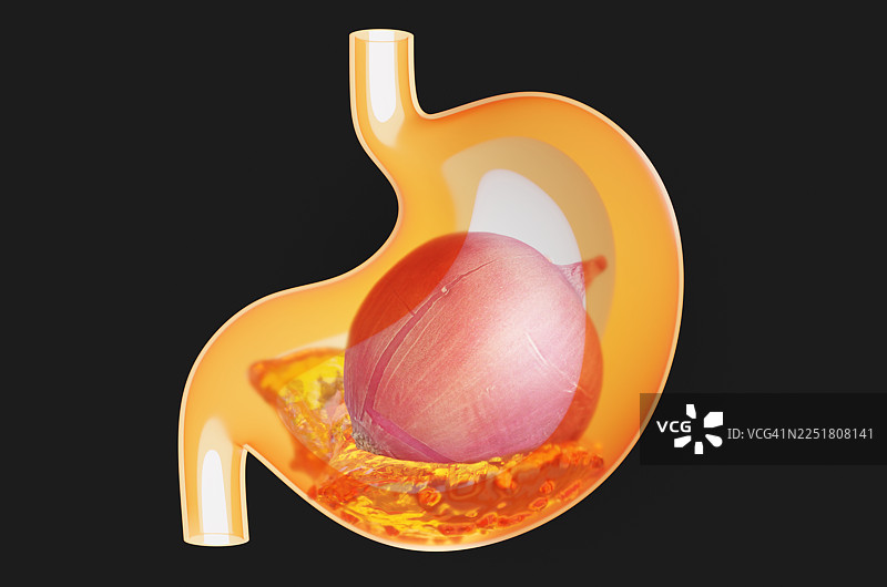 黑色背景下，透明胃里的新鲜洋葱特写，胃液在旁图片素材