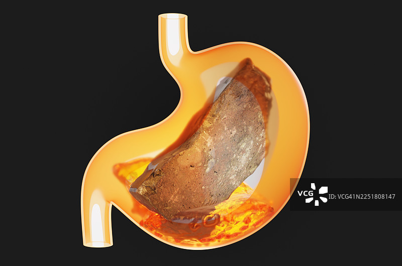 黑色背景下，透明胃里的脏砖特写，带有胃液图片素材