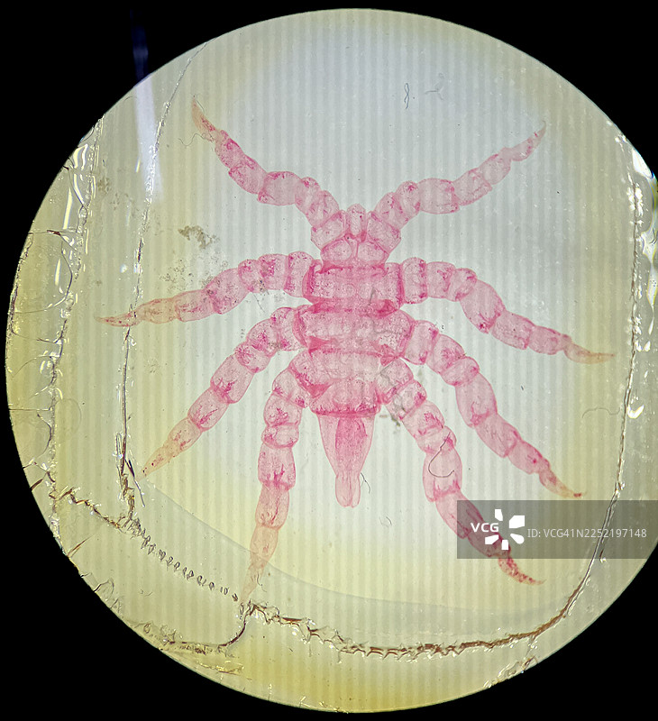 显微镜下的海蜘蛛（Pycnogonida）标本，粉色染色图片素材