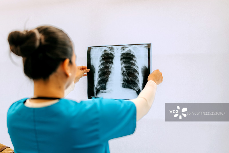 女医生在医院办公室里查看肺部X光片图片素材